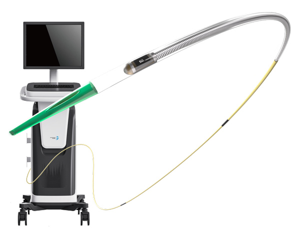Peripheral Intervention Industry